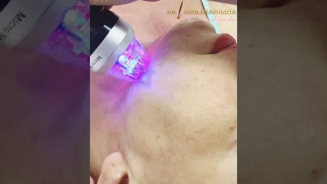 Fractional rf