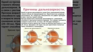 8 класс. Глаз как оптическая система, дефекты зрения и способы их исправления