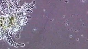 Амеба протей. Amoeba proteus