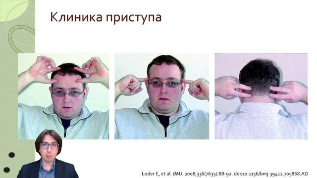 B1 1.6 Головные боли напряжения - диагностика и дифференциальная диагностика смотреть онлайн