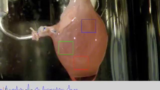 Искусственное сердце смотреть онлайн