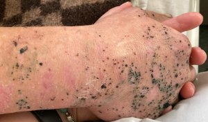 Мытарства раненых в СВО