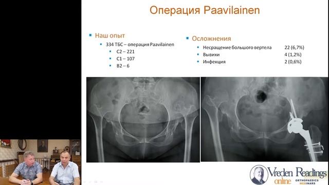 Вебинар 7 июля в 16-00 (MSK) Основные ошибки эндопротезирования тазобедренного сустава.mp4