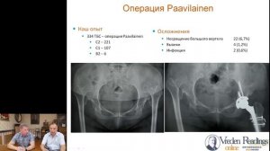 Вебинар 7 июля в 16-00 (MSK) Основные ошибки эндопротезирования тазобедренного сустава.mp4