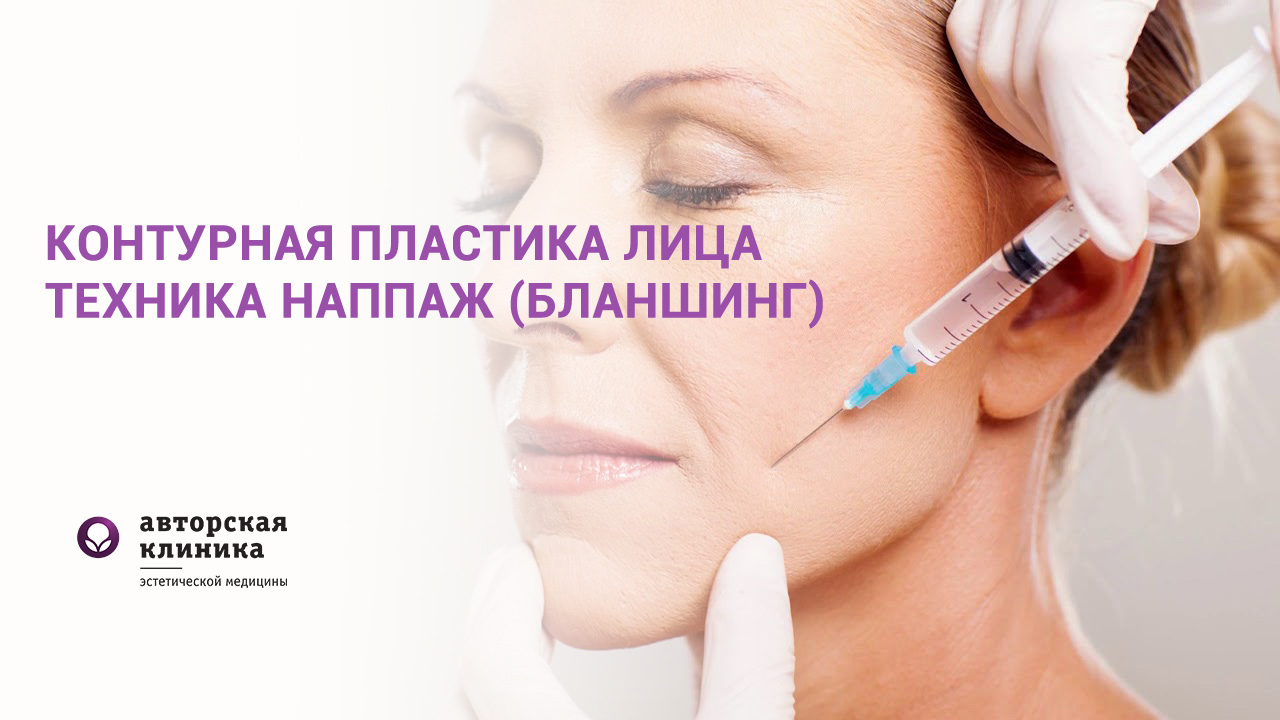 Контурная пластика лица, техника наппаж