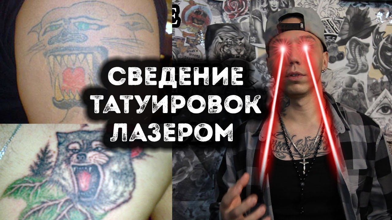 УДАЛЕНИЕ ТАТУИРОВКИ ЛАЗЕРОМ | ВСЁ О ЛАЗЕРНОМ УДАЛЕНИИ
