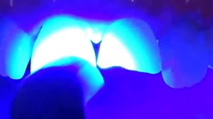 Прямая реставрация переднего зуба за 3 минуты. Восстановление переднего зуба