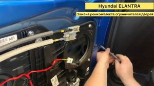 До vs После: Hyundai Elantra/ как восстановить фиксацию дверей с помощью ремкоплекта FIX AVTO  ✅