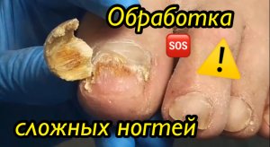 Обработка сложных ногтей ??⚠️❗️??