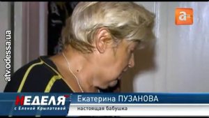 В  Одессе живёт единственный в мире малыш без черепа