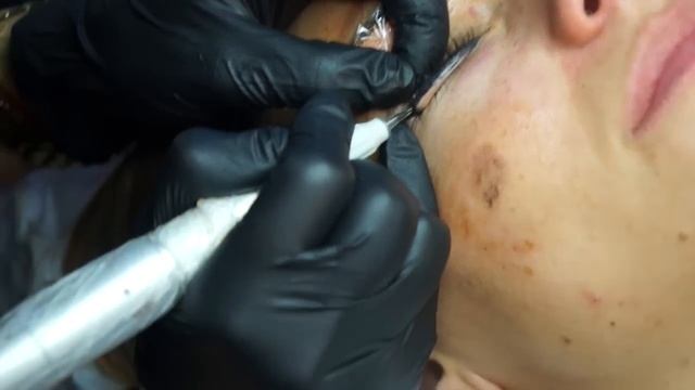 Getting Permanent Makeup: Before and After