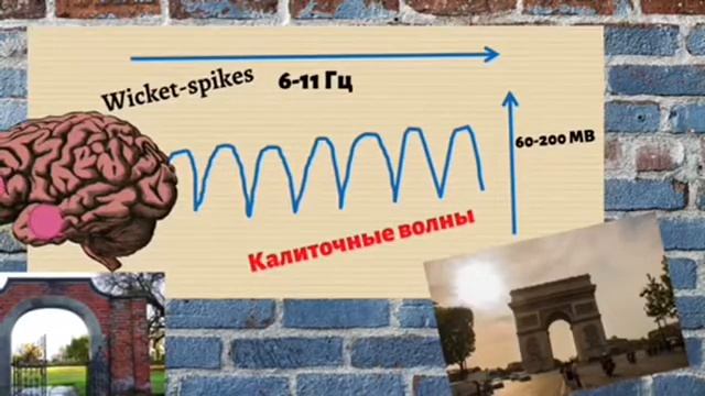 Wicket-волны. Калиточные волны смотреть онлайн