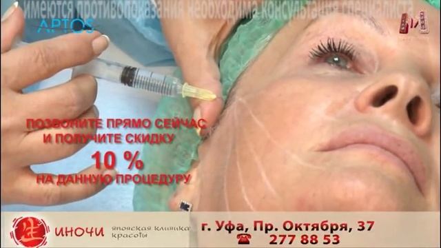 ИНОЧИ нити аптос