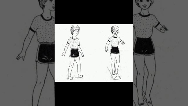 Двускатная доска при вальгусе. Результат за 2 года хождения по ней.