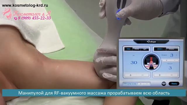 Горячий вакуумный массаж с RF лифтингом Процедура горячий вакуум РФ смотреть онлайн