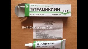 Опух глаз (ячмень) у ребенка 5 лет и взрослого Чем лечить - ЛАЙФХАК от тети Сони