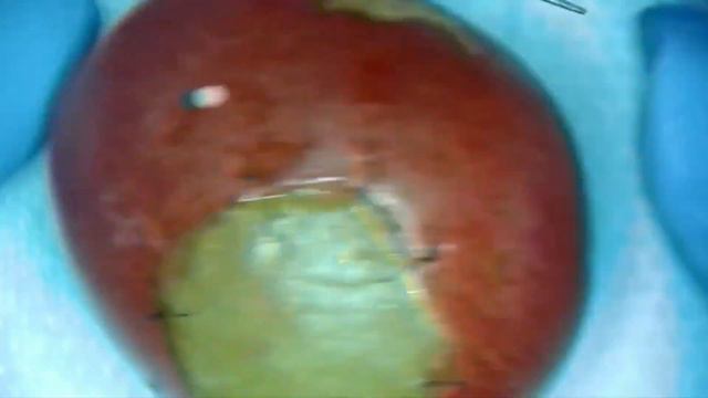 Простой узловой шов. НА ВИНОГРАДЕ смотреть онлайн