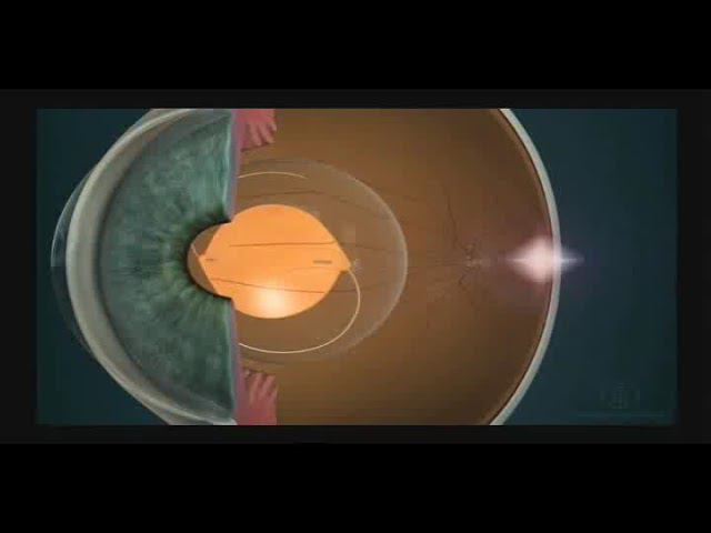 Торические линзы