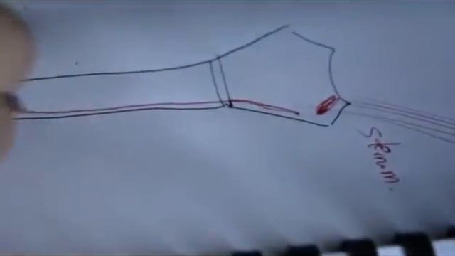 Bones of thorax ( sternum ) смотреть онлайн