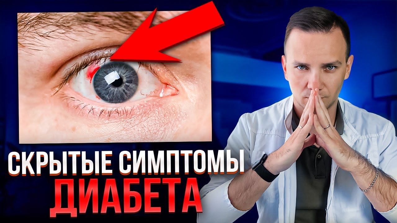 Это первые признаки ДИАБЕТА! Как вовремя распознать САХАРНЫЙ ДИАБЕТ?