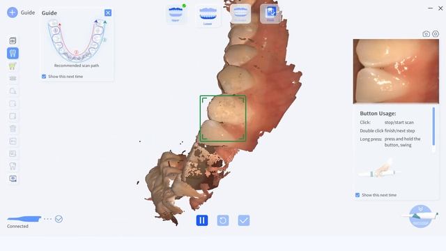 How to Use BLZ Intraoral Scanner with Software