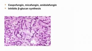 USMLE RX - 7.Микробиология - 1.Антимикробные средства - 37.Эхинокандины