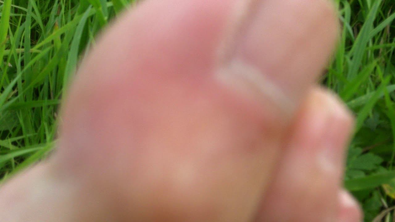 Загар смотреть онлайн