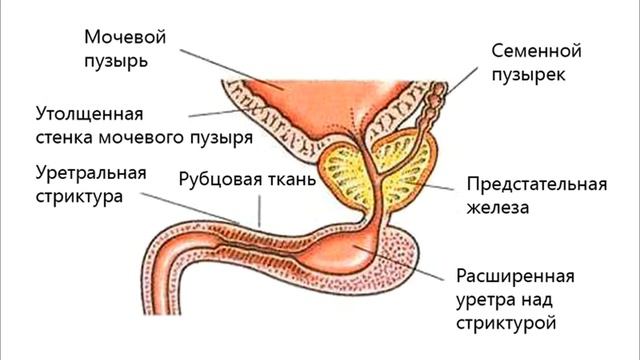 СИЙДИК ТУТИЛИШИ ВА УНГА БИРИНЧИ ЕРДАМ.