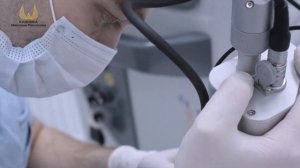 Лазерная со2-шлифовка лица