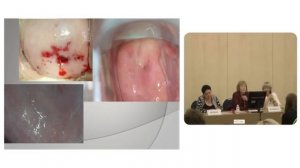 Кольпоскопия : сложные клинические ситуации.