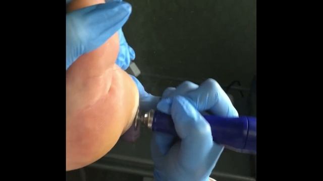 Смарт диск для педикюра р320 смотреть онлайн