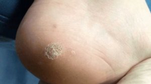 Сугал инсонда нима сабаб пайдо булади