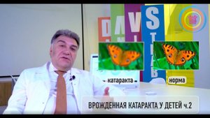 Врожденная катаракта у детей ч.2