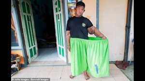 Самый толстый мальчик в мире, который весил 192 кг в 10-летнем возрасте