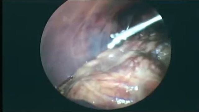 Диагностическая лапароскопия собаки смотреть онлайн