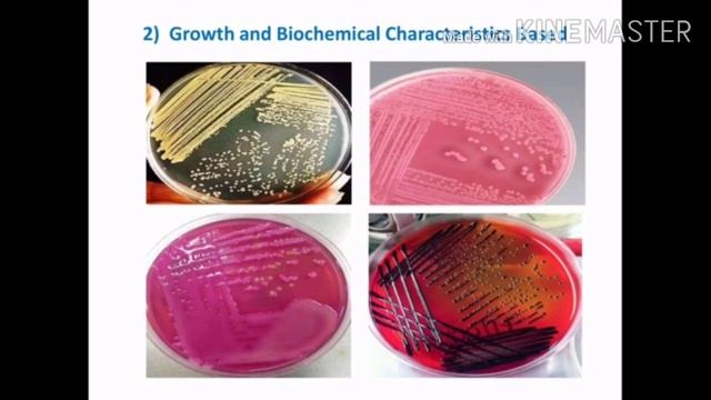 Identification of Microorganism || Dr. Sanjay Kumar, PhD смотреть онлайн