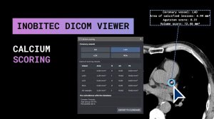 Оценка коронарного кальция в Inobitec DICOM Viewer Pro