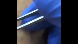 Вросший волосы/Relax Every Day ?Самое залипательное видео