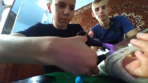 Снимаю гипс)