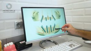 Если нет всех зубов