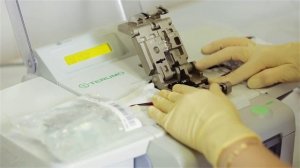 Получение концентрата тромбоцитов методом пулирования лейкотромбослоев