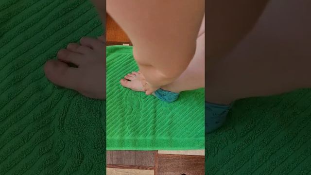 Удаляю сосудистые звёздочки народным способом. #сосуды #сосудистыезвездочки #народныйспособ #ноги смотреть онлайн