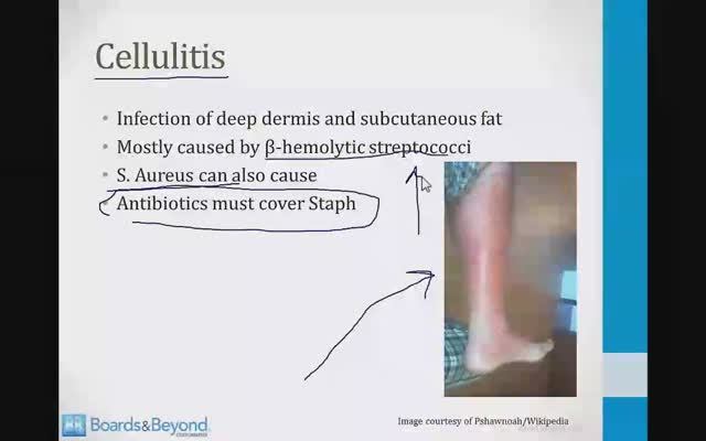 Инфекционные заболевания USMLE - 2. Бактерии - 1.Стафилококки