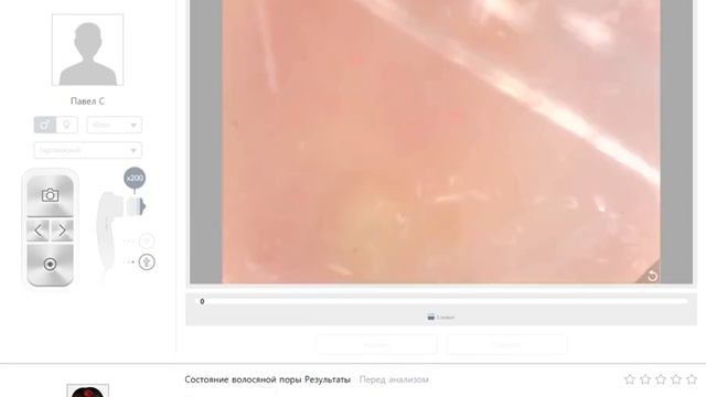 ASW диагностика волос и кожи головы смотреть онлайн