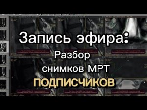 Расшифровка боли в пояснице: анализ МРТ снимков подписчиков.