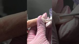 Выпиливание из под ногтей гель