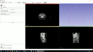 Basics 1: Start with 3D Slicer, extensions, load CT scan, navigation, saving