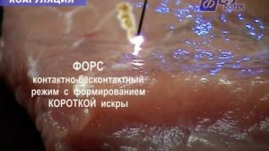 Видеоруководство по применению аппарата "ФОТЕК Е81М"