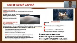 ГЕРМИНОГЕННЫЕ ОПУХОЛИ ЯИЧНИКОВ У ДЕТЕЙ И ПОДРОСТКОВ
