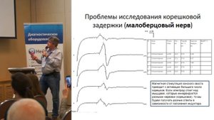 С.Г. Николаев,  Диагностика радикулопатий